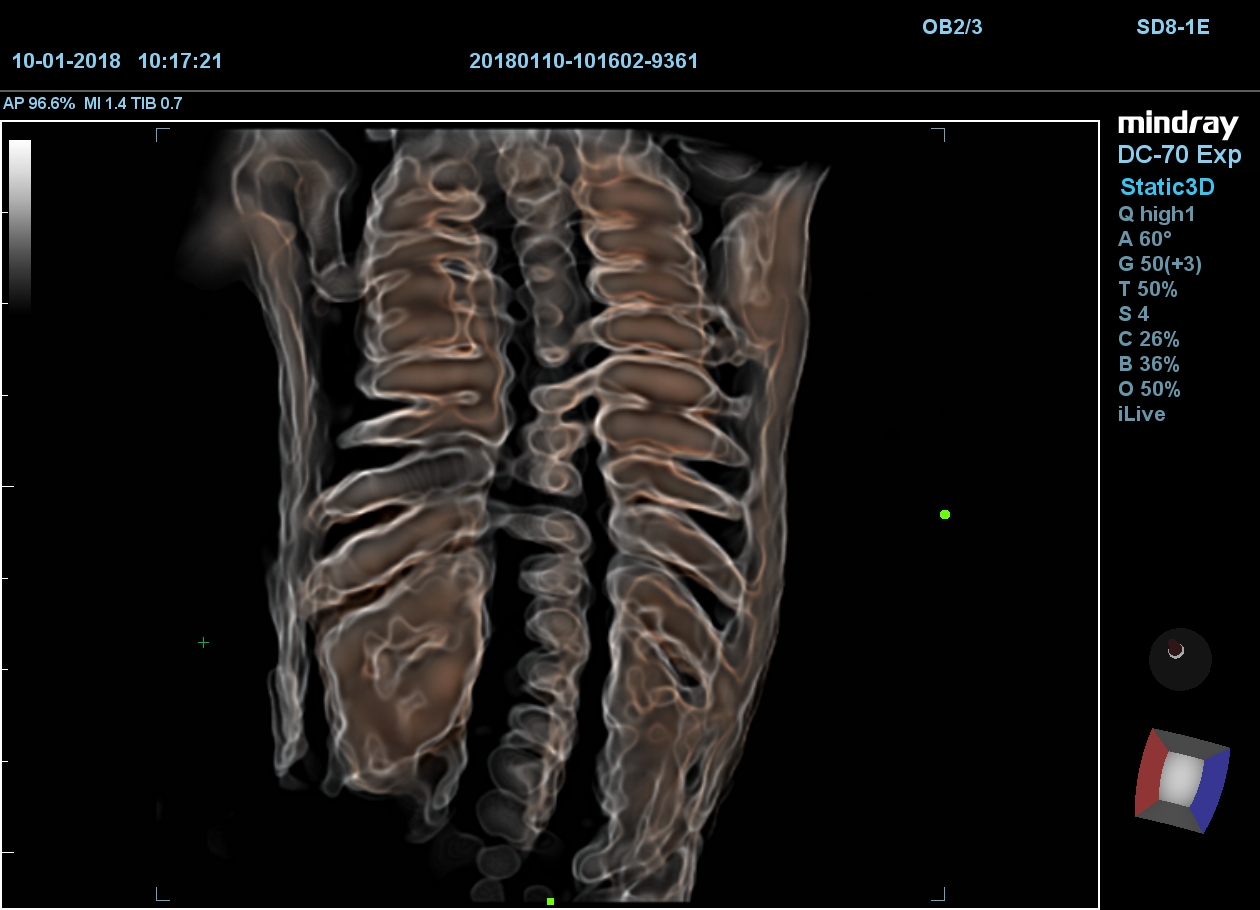 MINDRAY DC-70 X-nsight
