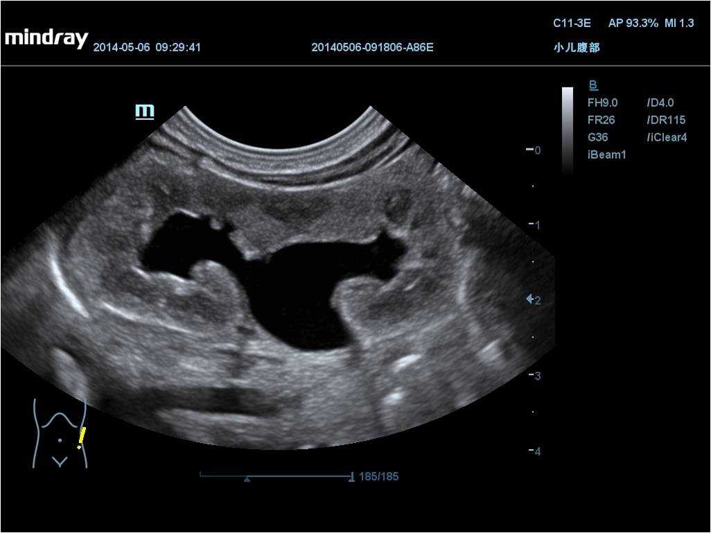 MINDRAY DC-70 X-nsight