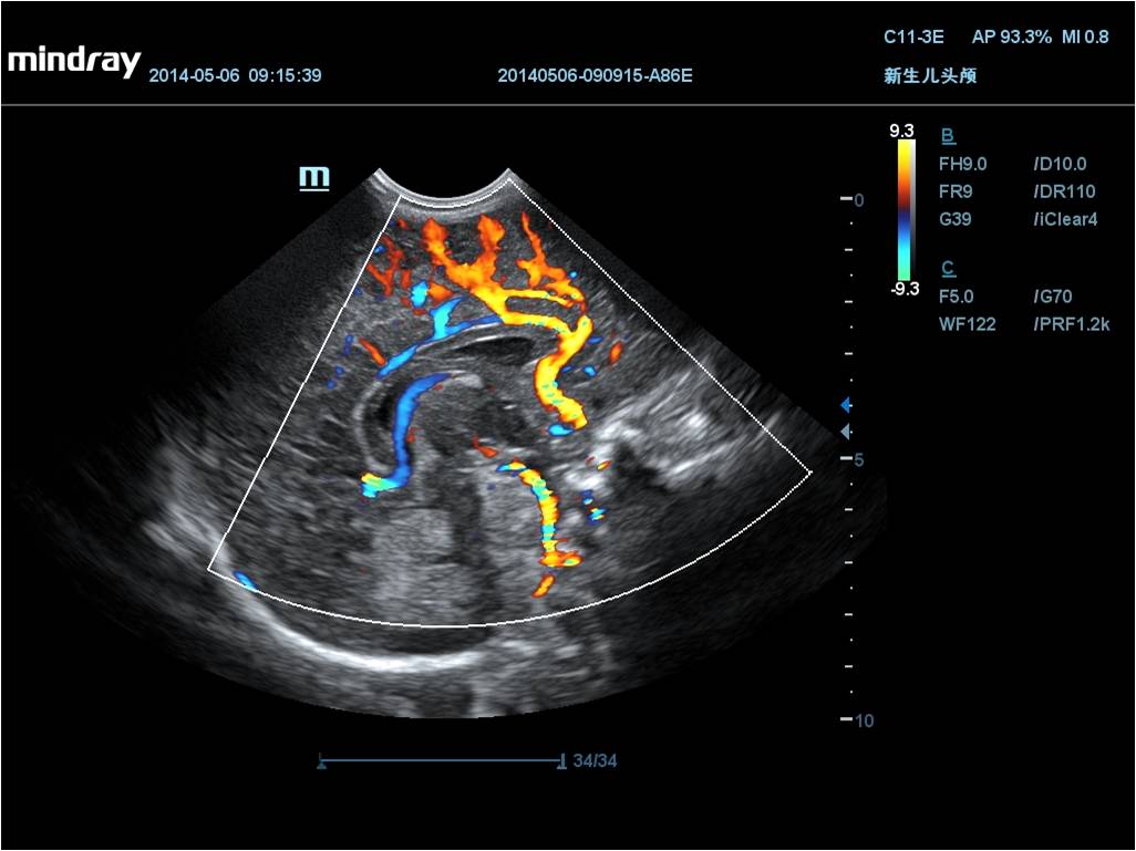 MINDRAY DC-70 X-nsight