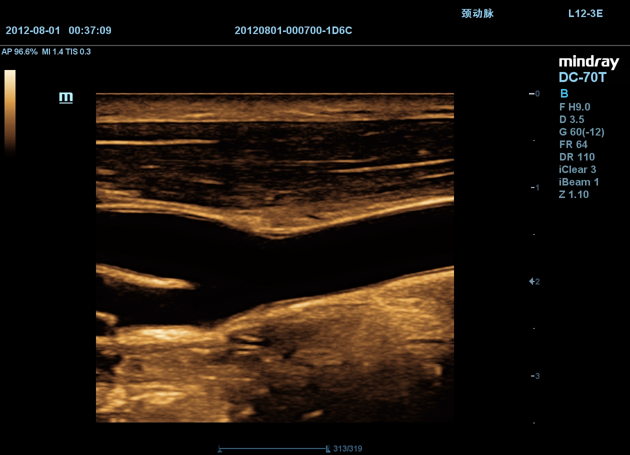 MINDRAY DC-70 X-nsight