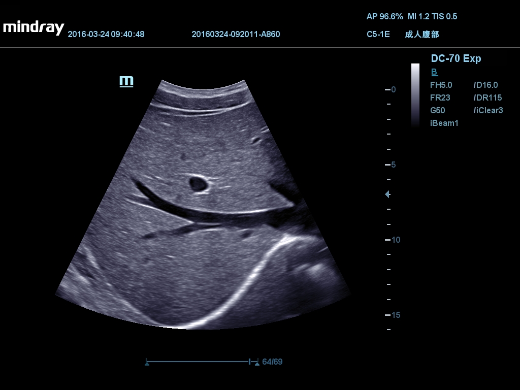 MINDRAY DC-70 X-nsight