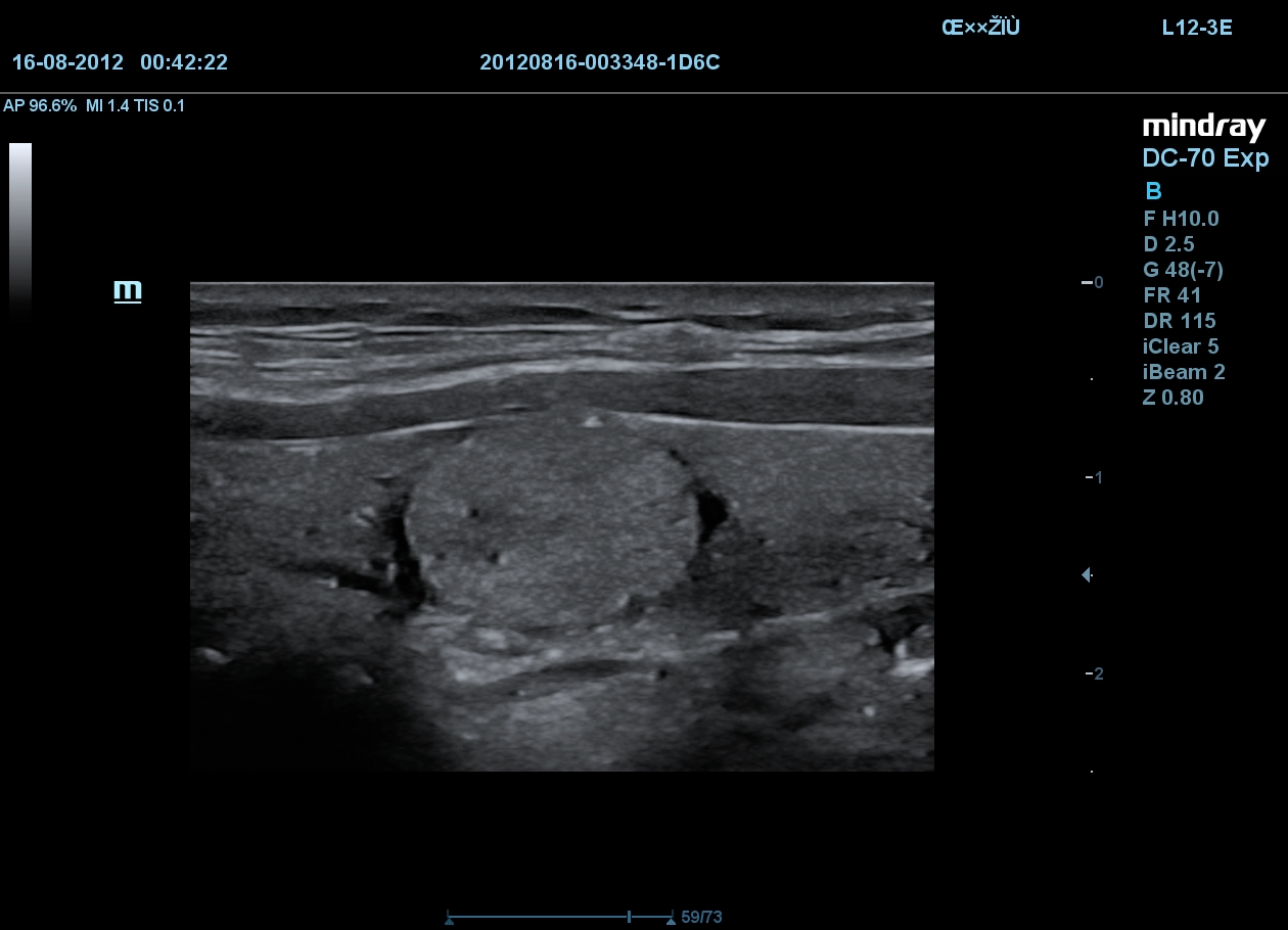 MINDRAY DC-70 X-nsight