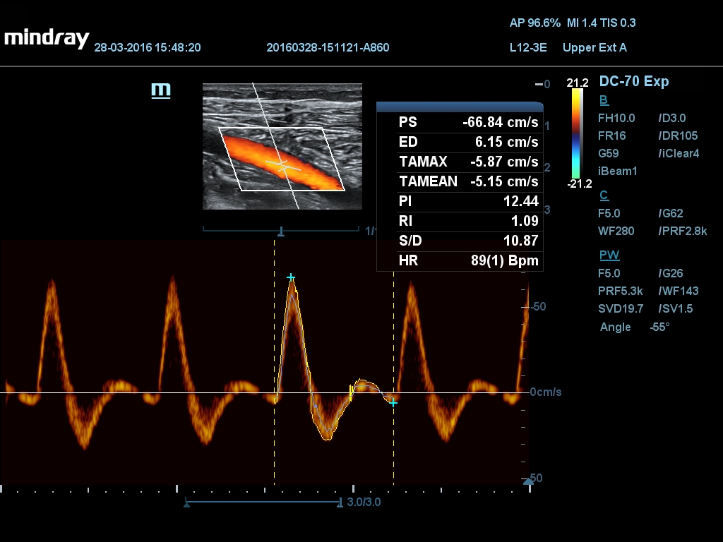 MINDRAY DC-70 X-nsight