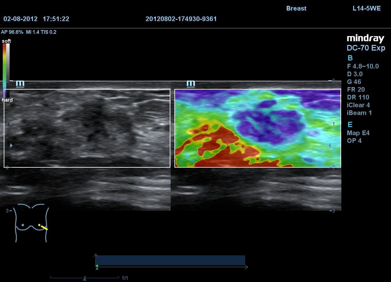 MINDRAY DC-70 X-nsight