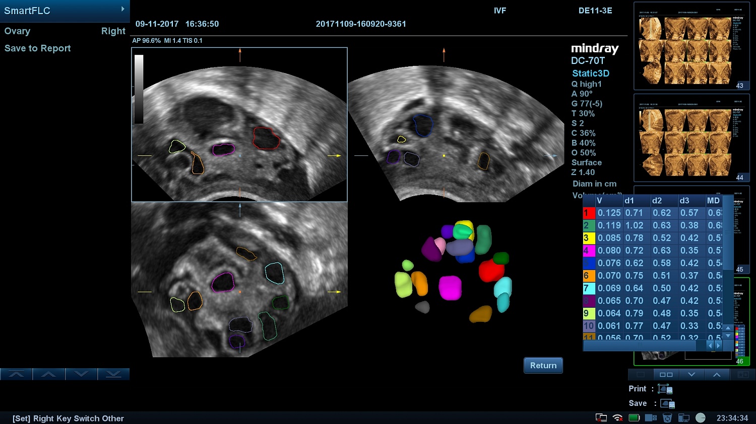 MINDRAY DC-70 X-nsight
