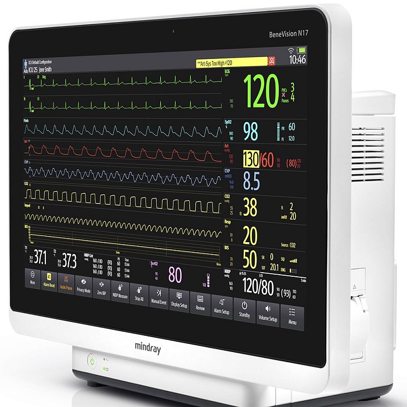 MINDRAY BeneVision N12/15/17